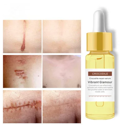 

Wholesale Lanbena Scar Organic Serum Removal Scar Stretch Marks Repair Serum