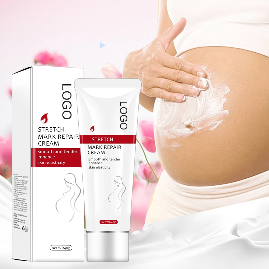 

OEM Pregnancy Stretch Mark Cream Private Label Acne Scar Removal Repair Cream Produits Pour Vergeture Stretchmark Remover Cream