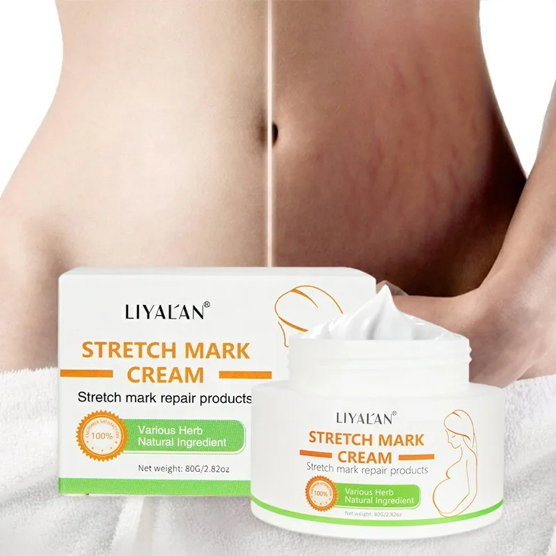 

Private Label Stretch marks Removal Cream Natural Organic Body Scar Repair Slack Line Pregnancy Abdomen Anti Stretch Mark Cream