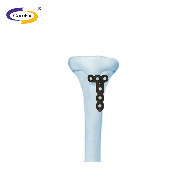 pediatric plate1.jpg