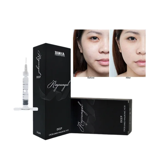 
Reyoungel Cross-linked acid hialuronico Injectable Filler For Rhinoplasty 