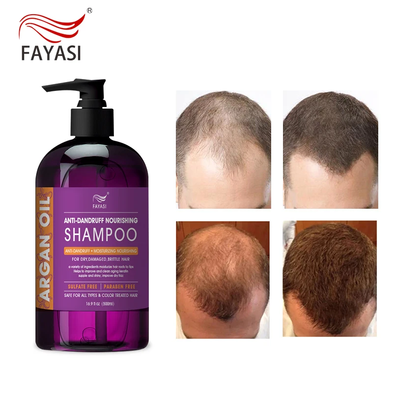 

The newest ladies hair treament argan oil shampoo and conditioner cabs hair treament shampoo