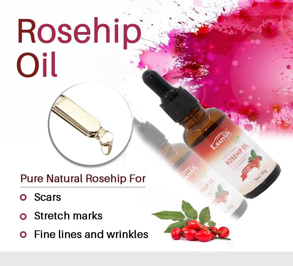 Crazylife Rose Hips Oil Essential Oil Body Essential Buy Essential Oil Body Essential Rose Hips Oil Product On Alibaba Com Crazylife Rose Hips Oil Essential Oil Body Essential Buy Essential Oil Body Essential Rose Hips Oil Product On Alibaba Com