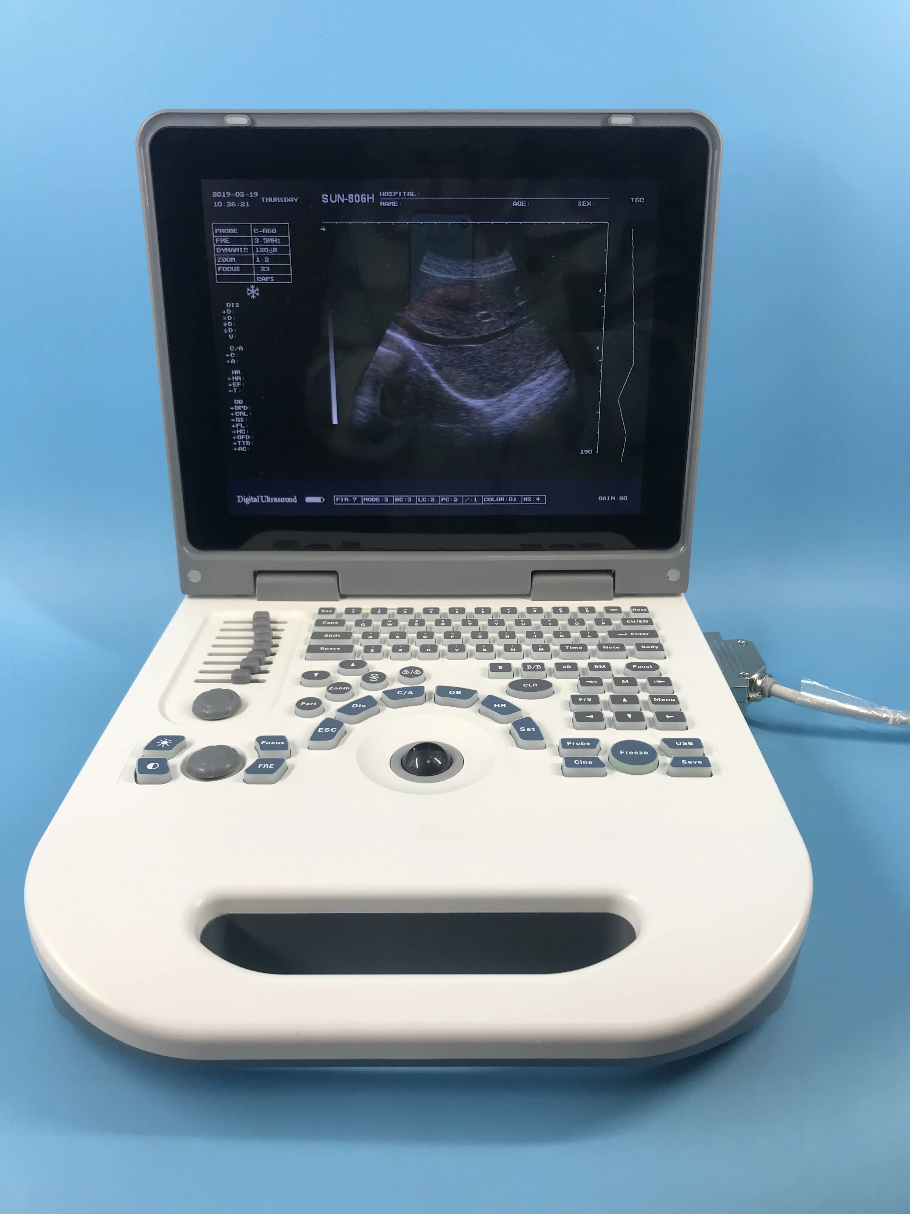 
New full digital portable 2d color echocardiography portable ultrasound machine for sale 