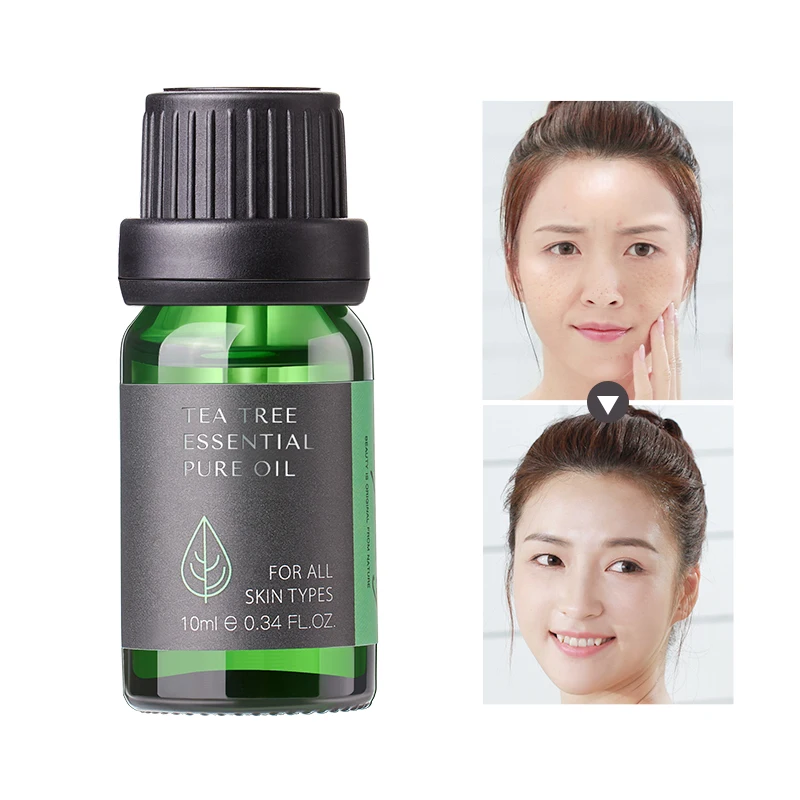 

10ML 100% Pure Tea Tree Anti Acne Oil For Refining Pores And Reducing Acne, Light yellow liquid