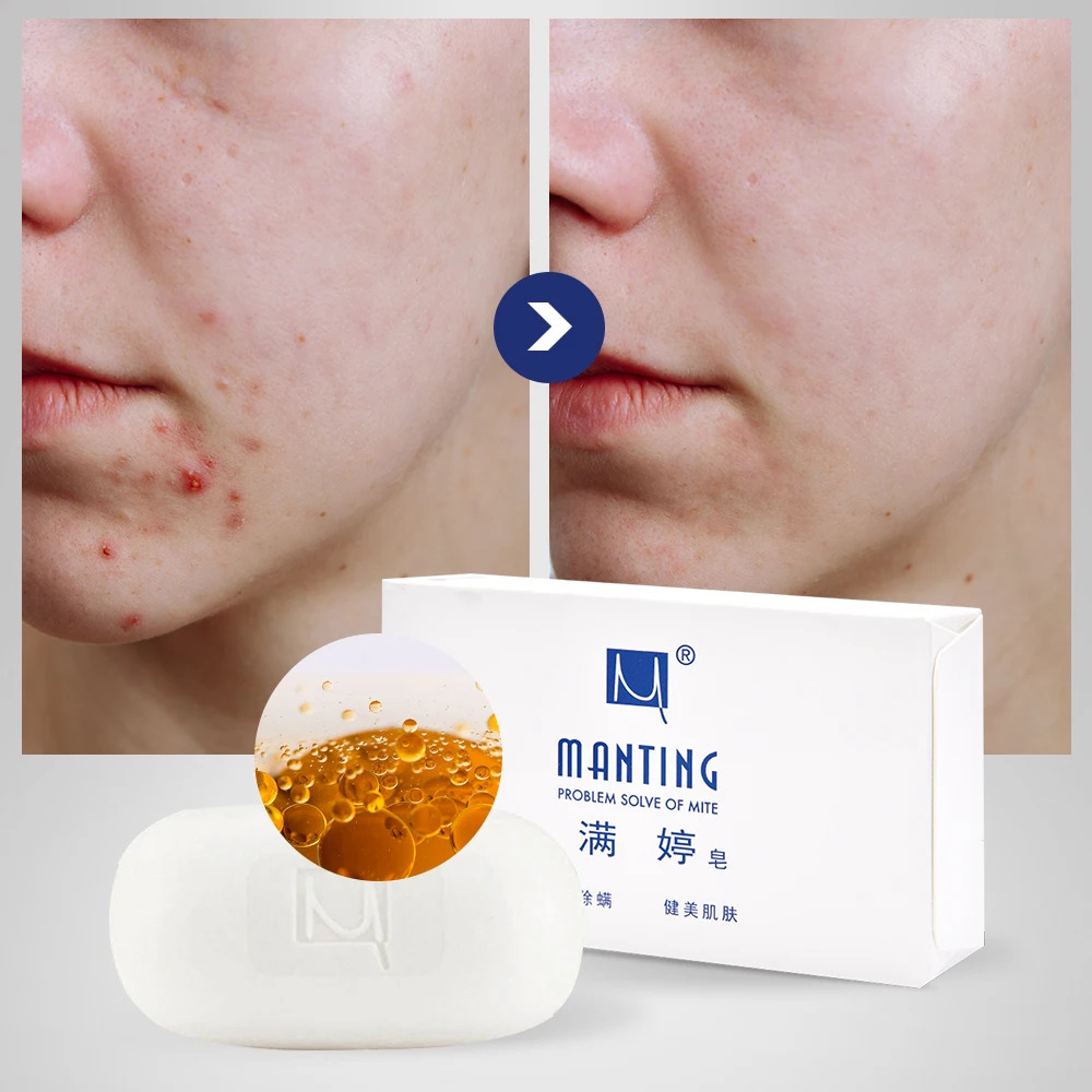 

Wholesale Hand Made Soaps Natural Organic Best Skin Care Remove Dark Spots Beauty Hand Soap Bar, White