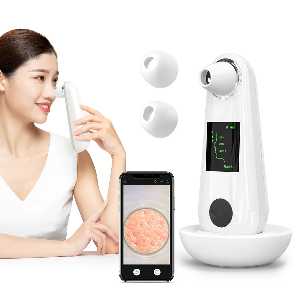 

OEM Service Visual HD Nose Blackhead Rechargeable Remover Vacuum WIFI Visible Vacuum Facial Pore Cleaner, White (accept oem colors)