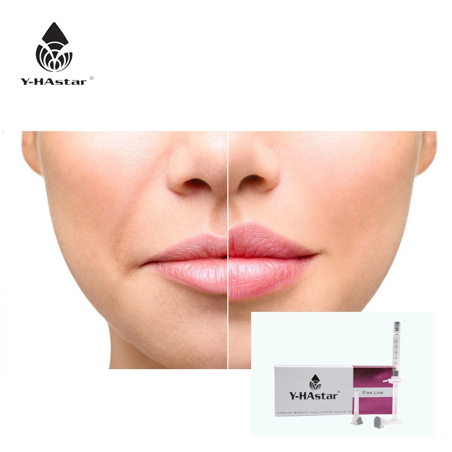 

Y-HAstar Lip Injections 5ml enlargement dermal filler for long lasting