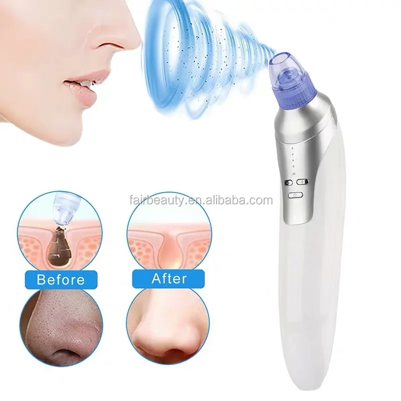 

FAIR Personal Care chargeable Pore Vacuum Suction New Blackhead Remover Suction Device Best Selling Products