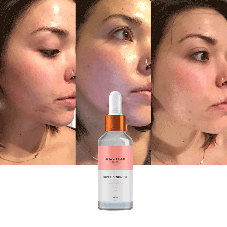 

Ready To Ship Glow It All Brand Moisturizing Glow Face Massage Essential Oil Sample Custom