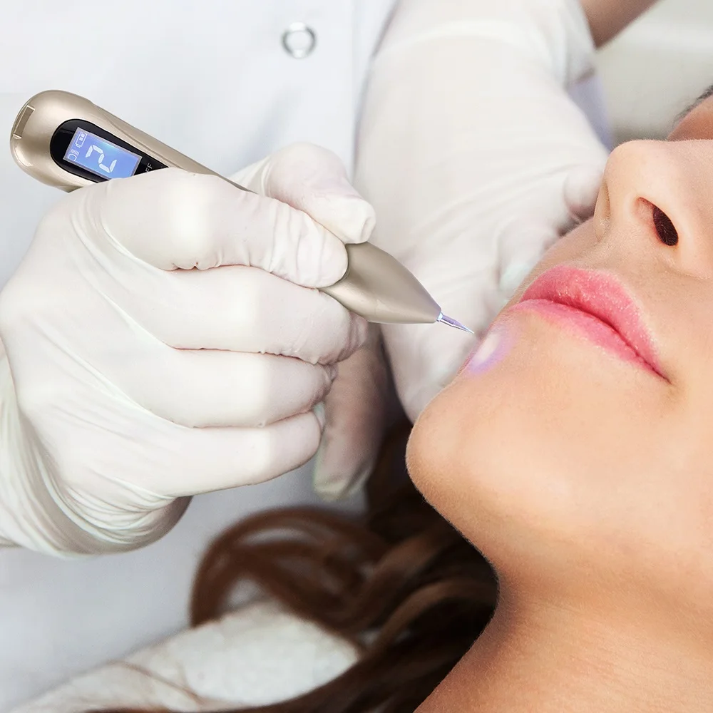 激光等离子体笔皮赘纹身去除设备工具暗斑皮赘卸妆笔