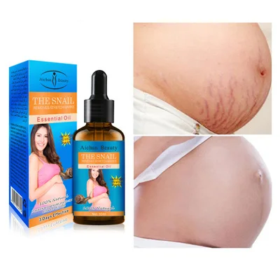 

Ai Chun Body Repair Essential Oil to Remove Fat Lines Pregnancy Obesity Line Repair Lightens 30ml