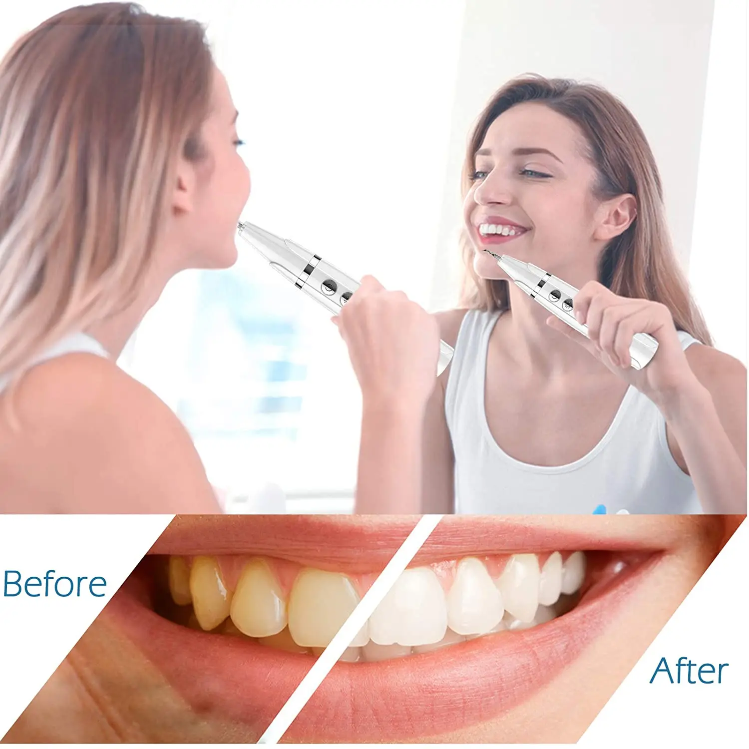 

JOSUNN Electric Ultrasonic Dental Calculus Detartreur Dentaire Ultrason Whitening Tartar Removal Tooth Whitening Tool, White