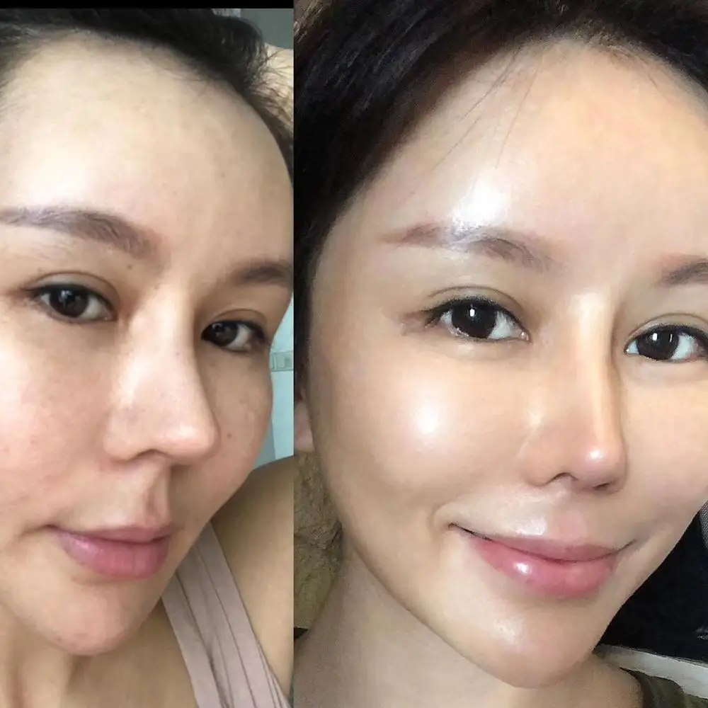 

Shangyang Dermaheal sb solution serum skin care Professional Skin Brightening