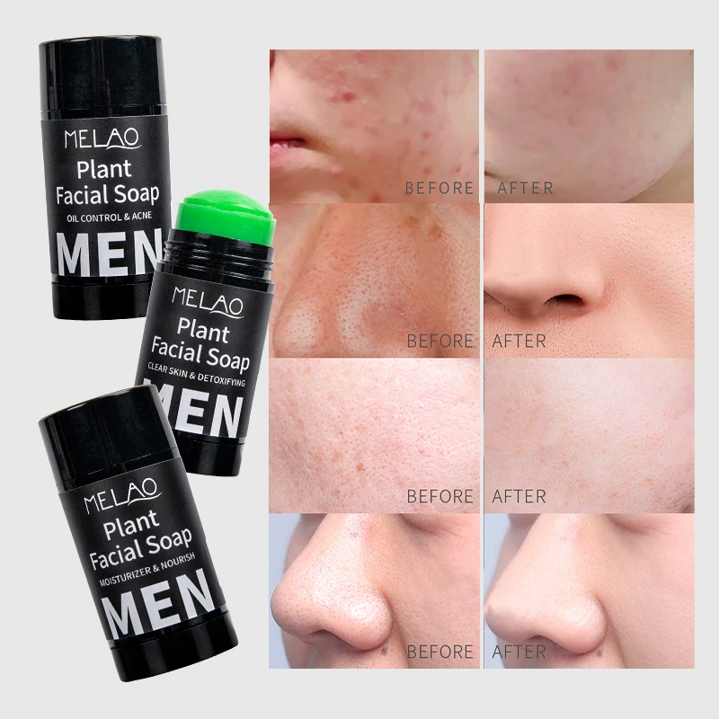 

MELAO Private Label Facial Eco-Friendly Soap Detoxfying Oil Control Acne Moisturizer Nourish Plant Facial Soap Bar For Men