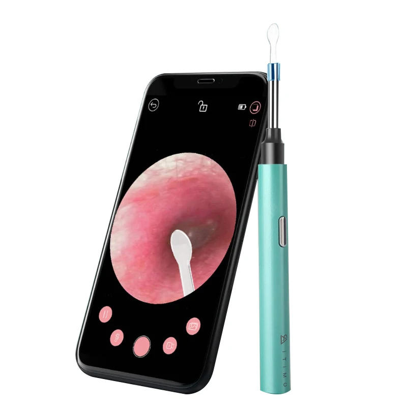 

Smart Visual Earwax Remover Tool for Cleaning Ear Canal at Home