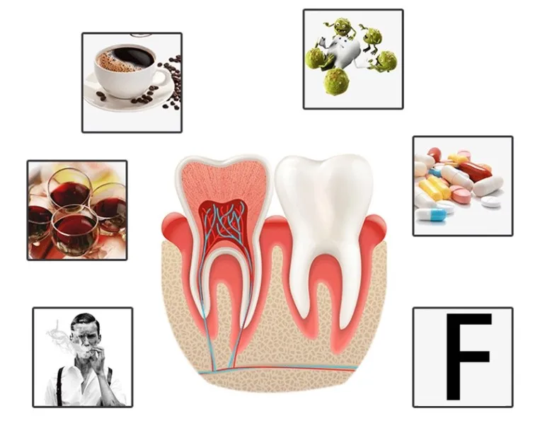 teeth problems.JPG