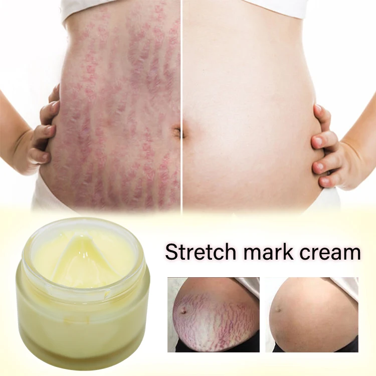 

make your own vitamin c retinol hyluronic acid repair cream private label fat people scar remover stretch mark cream