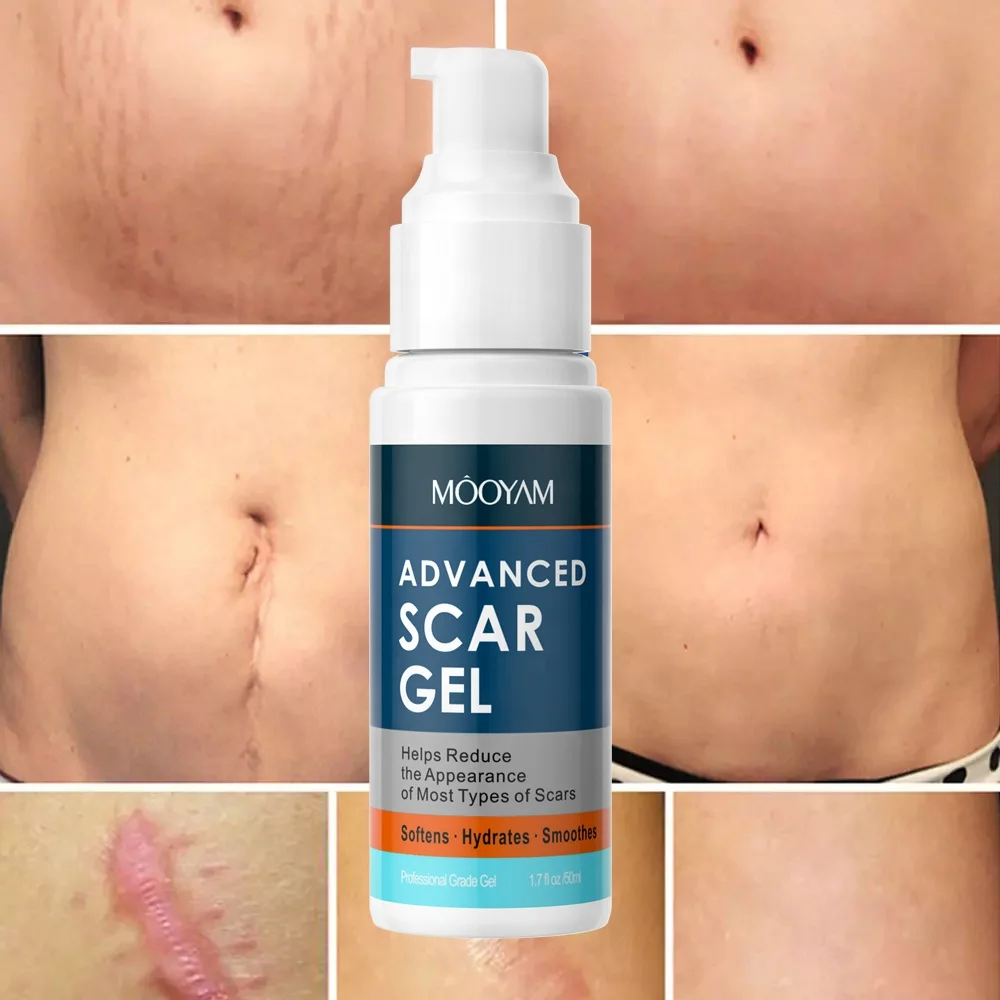 

Strong Effective Acne Scar Removal Gel Pimples Stretch Marks Remove Face Gel Tummy Tuck Tightening Advanced Scar Gel