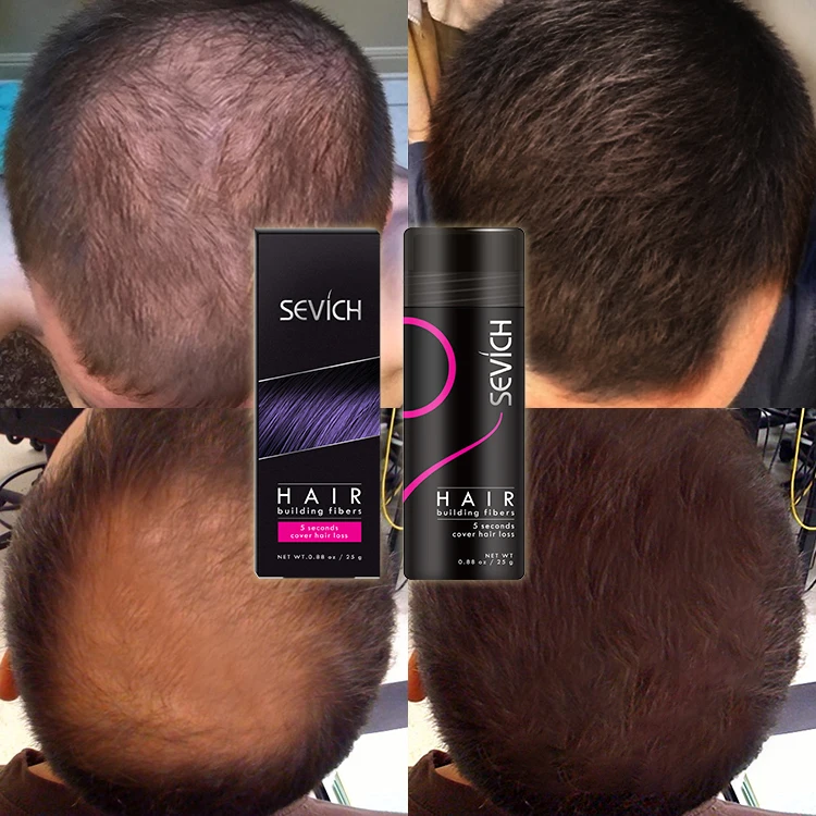 

Custom Logo Organic Styling Keratin Hair Fibre Powder Spray Applicator Private Label Hair Building Fiber