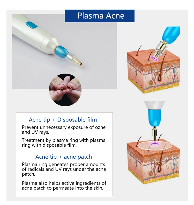 Beauty Plasmapen Wrinkle Mole Removal Eye Lift Plasma Pen