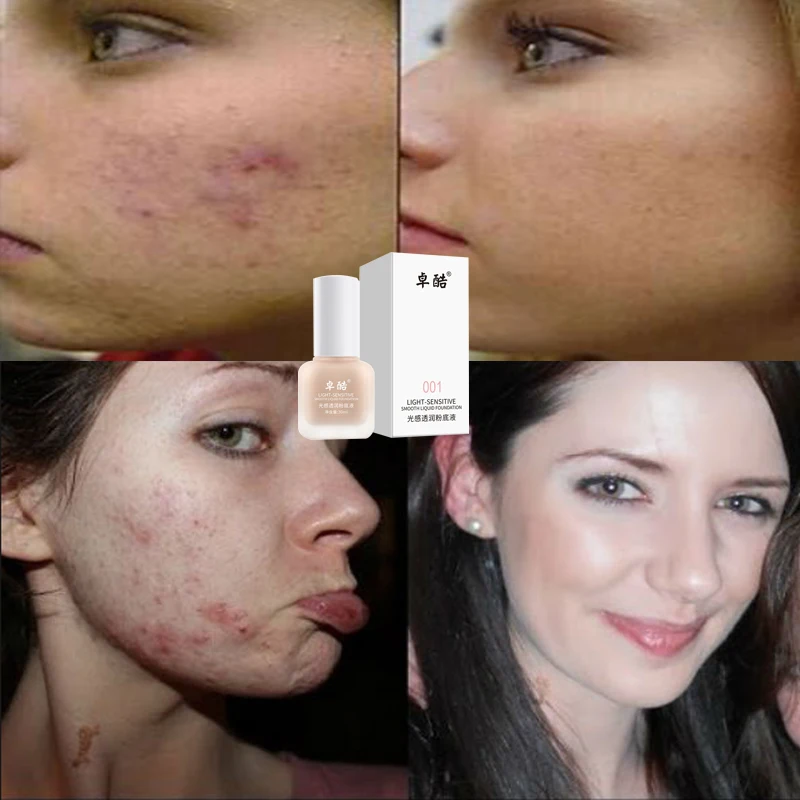 

Liquid Foundation 001 Light Sensitive Concealer Brightens Skin Color Modifies Acne Marks