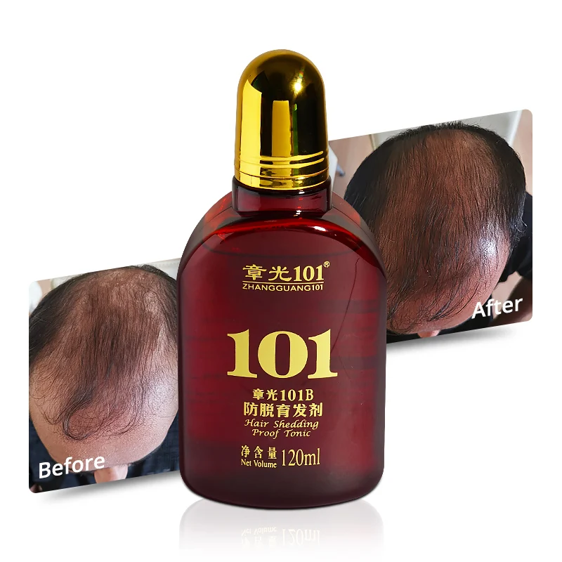 

High Quality 7 Days Fast Hair Oil Control Hair Loss Hair Care Tonic Product