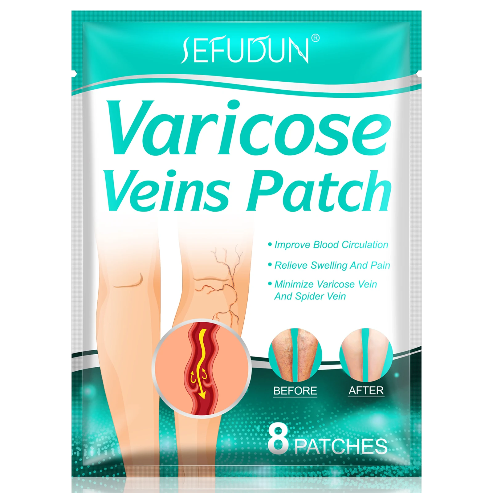 

OEM Varicose Veins Patch Relief Leg Pain Strengthens Capillary Health Improve Blood Circulation Varicose Veins Treatment Paste