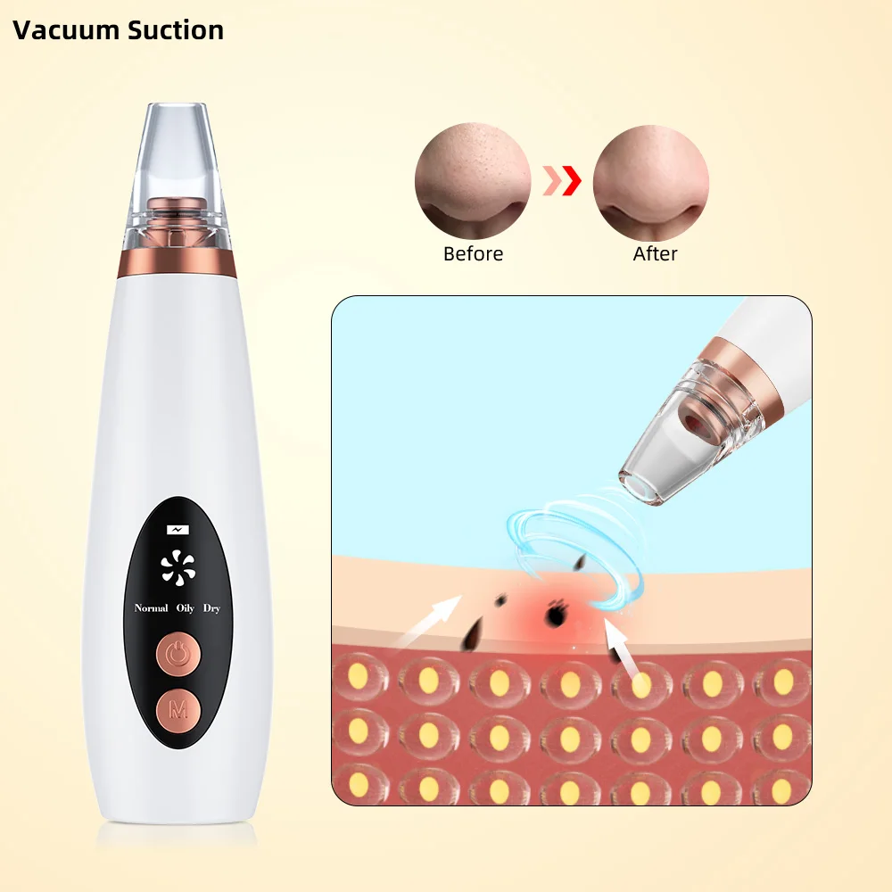 

Vacuum facial electric blackhead remover blackhead instrument electric pore cleaner black head removal comedo suction, White