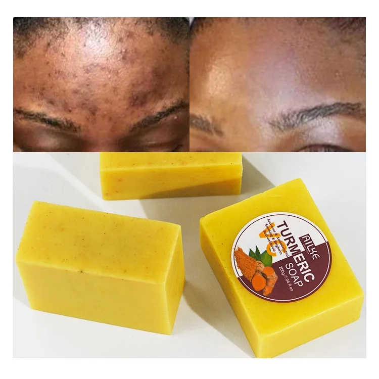 

Private Label Skin Care Vegan Soaps Brightening Whitening Skin Lightening Turmeric Soap For Acne