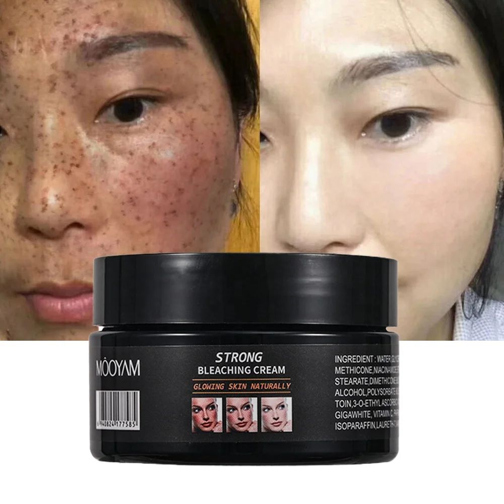 

120g Skin Powerful Whitening Freckle Cream Remove Melasma Acne Spots Pigment Melanin Dark Spots Face Strong Bleaching Cream