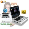 Biggest discount! clear images 2D notebook ultrasound machine price