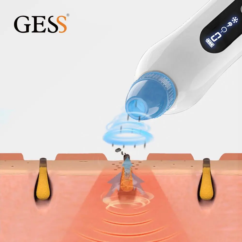 

High Quality Electric Blackhead Remover Dissolvant De Points Noirs, White