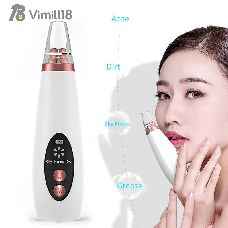 

Suction BlackHead Cleaner ABS Acne cleaner Fast Blackhead Removal Equipment Cosmetic Instrument White Beauty Device, White/customized