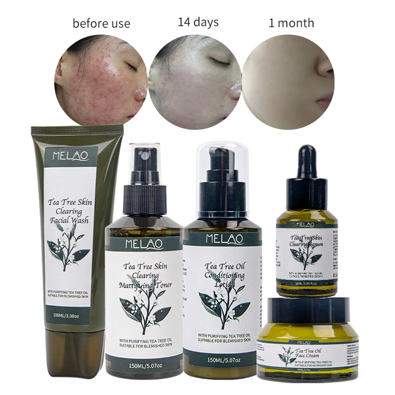 

Private Label Natural Organic Beauty Face Skin Care Set Anti Acne Repair Tea Tree Acne Set Includes Cleanser, Toner, Serum