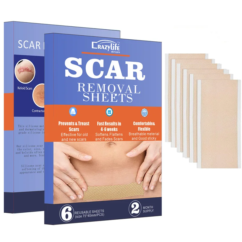 

Efficient Surgery Self-Adhesive Silicone Gel Tape Removal Scar Tape Therapy Patch for Acne Trauma Burn Scar Skin Repair Dropship
