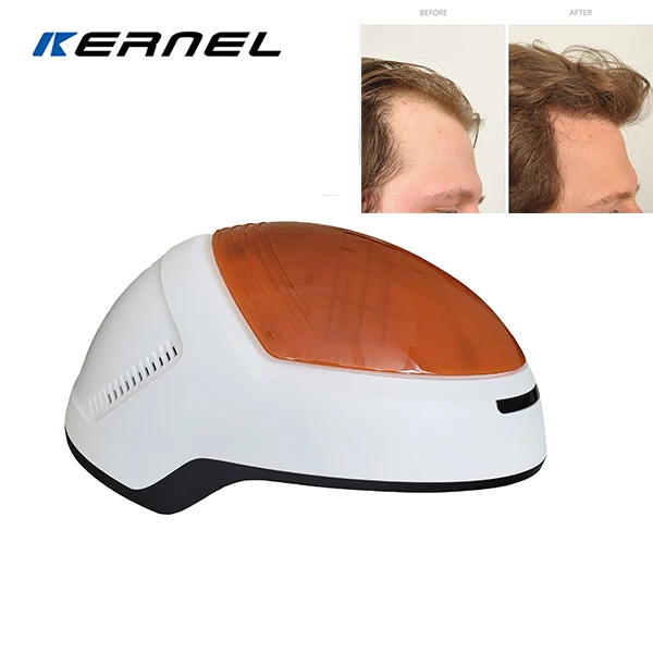 

80 Diodes LLLT Hair Loss Therapy Laser Cap Hair Growth Promoter Germinal Helmet