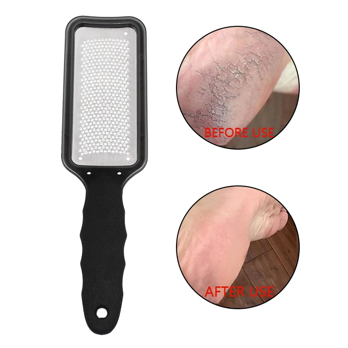 

Colossal Pedicure Scrubber Tool Callus Remover Corn Trimmer Foot Rasp File