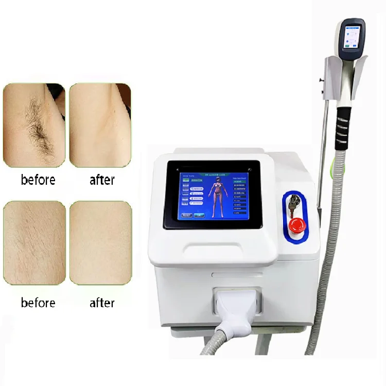 

2022 New 808nm Skin Rejuvenation Diode Laser Machine Machine Hair Remover