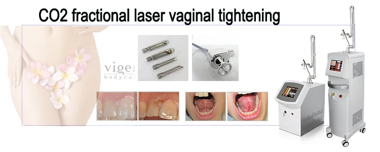 laser fractional co2.jpg