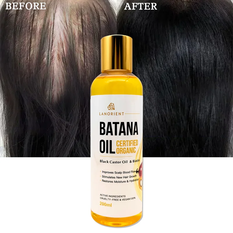 Private Label LANORIENT 100% Natural Organic Hair Protection Batana Oil for Hair Growth