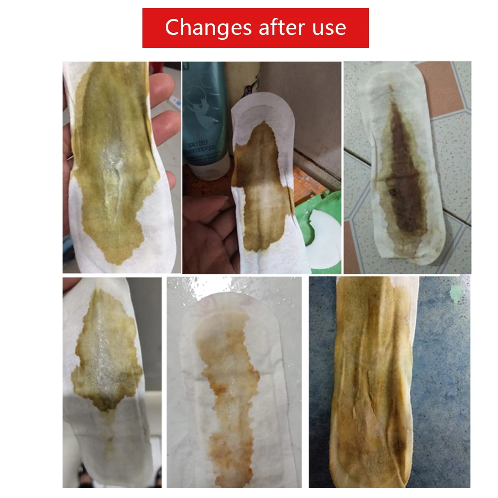 Factory Wholesale Oem Herbal Cotton Pad Vaginal Cleaning Pad Vaginitis Effective Yoni Care