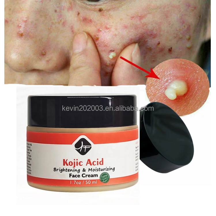 

Natural whitening cream Private Label Brightening cream Vitamin C Kojic Acid skin care For Face KOJIC AICD face cream