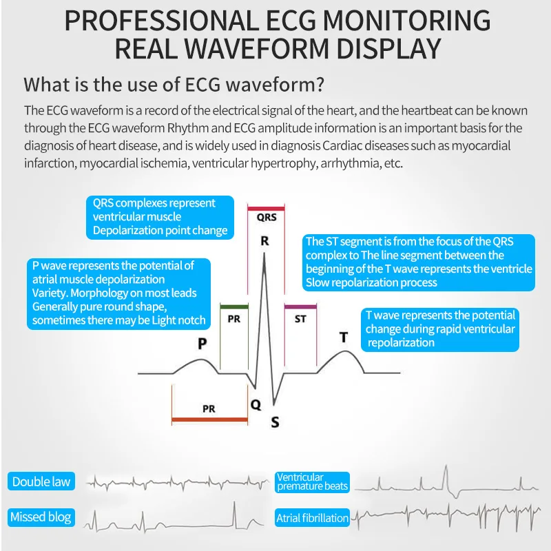 product medical easy cheap holter wireless handheld home mini realtime single lead ecg monitor machine-63