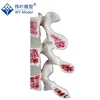 Osteoporosis Spinal Column Joint Skeleton Model,Cut Lumbar Vertebrae Model