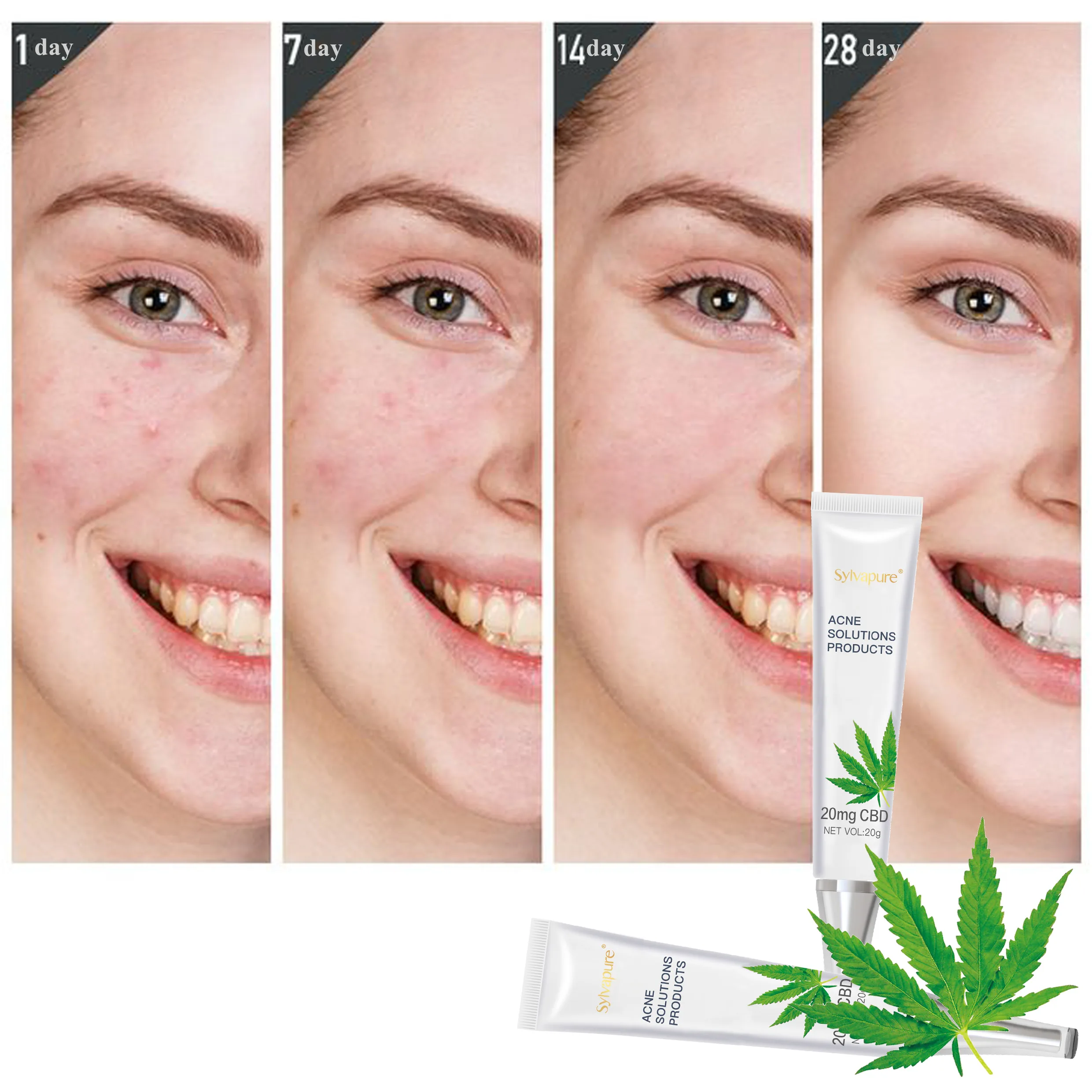 

New Arrival China Good Supplier Acne Cream Pimples Proactive Acne Serm, Milk white