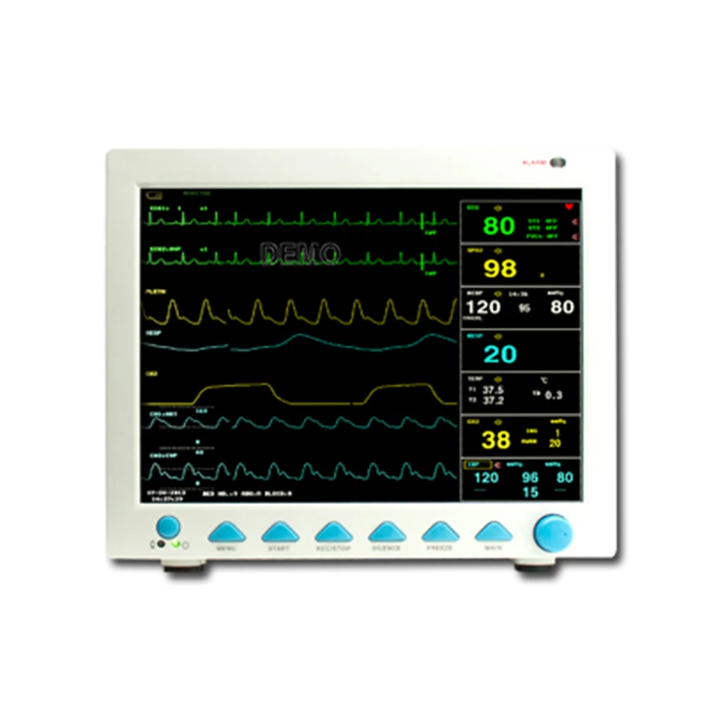 Contec cms. Patient Monitor cms8000. Монитор cms 8000. Монитор пациента портативный. Монитор пациента на 5 параметров.