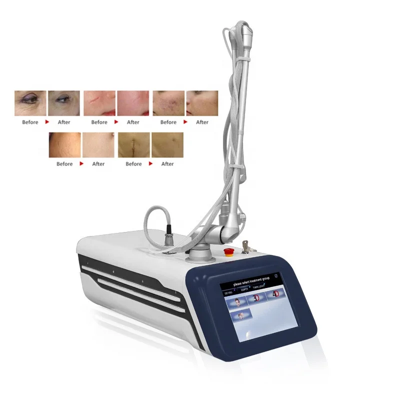 

Portable Co2 Fractional Laser Machine for Vaginal Tightening Stretch Marks Scar Removal