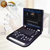 Hospital powerful function vascular Doppler handheld color Doppler SUN-906A laptop ultrasonic diagnostic
