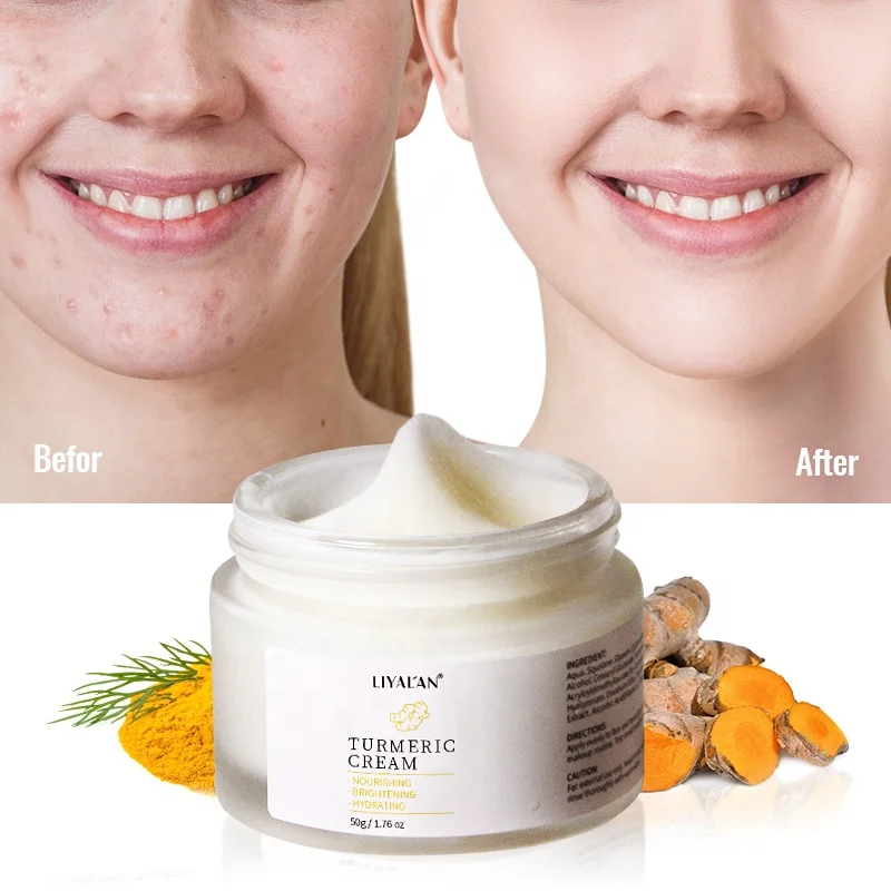 

Private Label Natural Tumeric Acne Scars Dark Spot Whitening Face Cream Organic Herbal Turmeric Cream